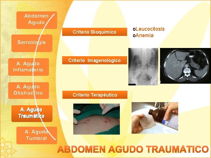Abdomen Agudo Criterio Bioquímico Semiología A. Agudo Inflamatorio A. Agudo Obstructivo A. Agudo Traumático