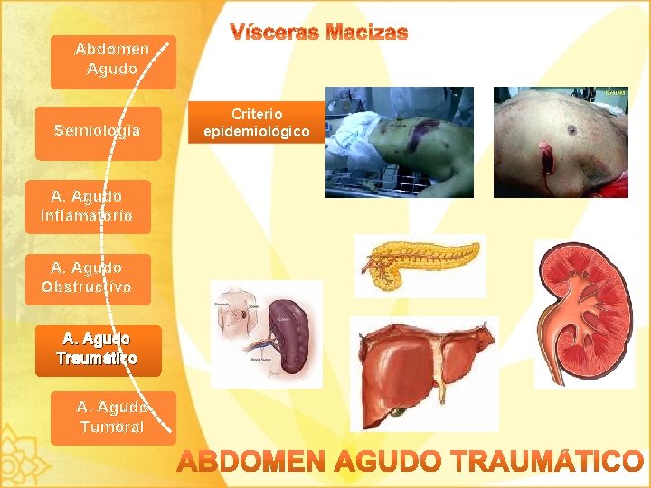 Abdomen Agudo Semiología A. Agudo Inflamatorio A. Agudo Obstructivo A. Agudo Traumático A. Agudo