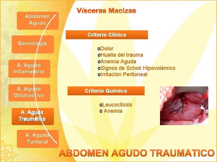 Abdomen Agudo Criterio Clínico Semiología A. Agudo Inflamatorio A. Agudo Obstructivo A. Agudo Traumático