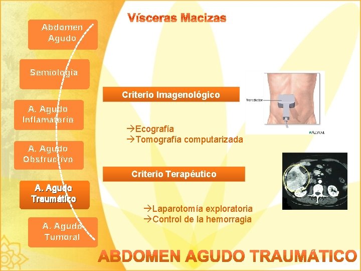 Abdomen Agudo Semiología Criterio Imagenológico A. Agudo Inflamatorio A. Agudo Obstructivo Ecografía Tomografía computarizada