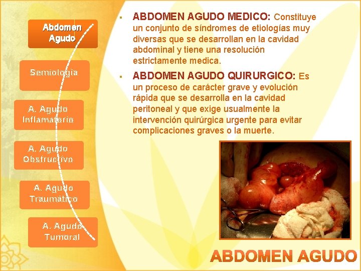 § Abdomen Agudo Semiología A. Agudo Inflamatorio A. Agudo Obstructivo A. Agudo Traumático A.