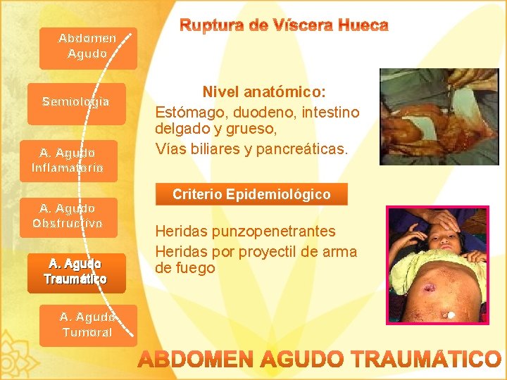 Abdomen Agudo Semiología A. Agudo Inflamatorio A. Agudo Obstructivo A. Agudo Traumático A. Agudo