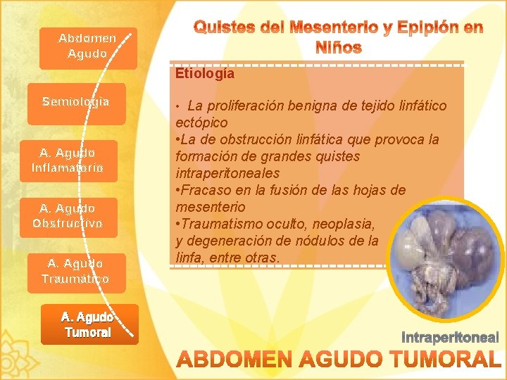 Abdomen Agudo Etiología Semiología A. Agudo Inflamatorio A. Agudo Obstructivo A. Agudo Traumático A.
