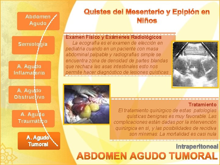 Abdomen Agudo Semiología A. Agudo Inflamatorio Examen Físico y Exámenes Radiológicos La ecografía es