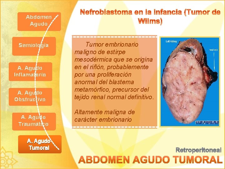 Abdomen Agudo Semiología A. Agudo Inflamatorio A. Agudo Obstructivo A. Agudo Traumático A. Agudo