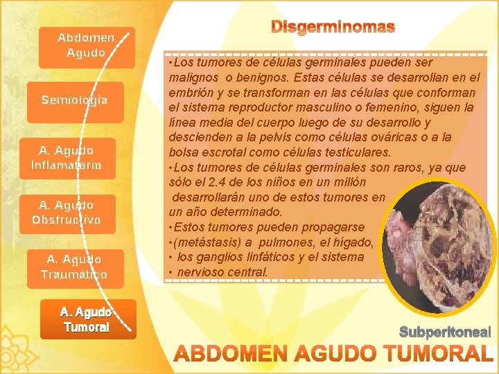 Abdomen Agudo Semiología A. Agudo Inflamatorio A. Agudo Obstructivo A. Agudo Traumático A. Agudo