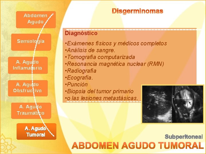 Abdomen Agudo Diagnóstico Semiología A. Agudo Inflamatorio A. Agudo Obstructivo • Exámenes físicos y