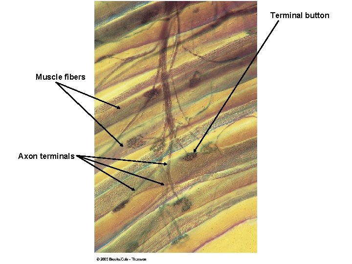 Terminal button Muscle fibers Axon terminals 