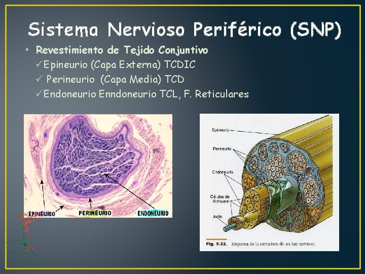 Sistema Nervioso Periférico (SNP) • Revestimiento de Tejido Conjuntivo üEpineurio (Capa Externa) TCDIC ü