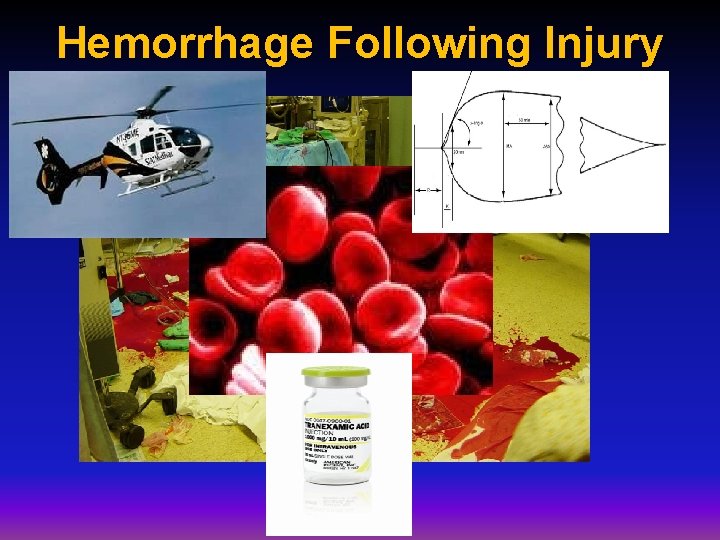 Hemorrhage Following Injury Hemorrhage Following Injury