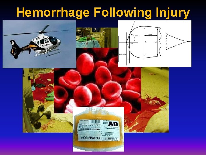 Hemorrhage Following Injury Hemorrhage Following Injury