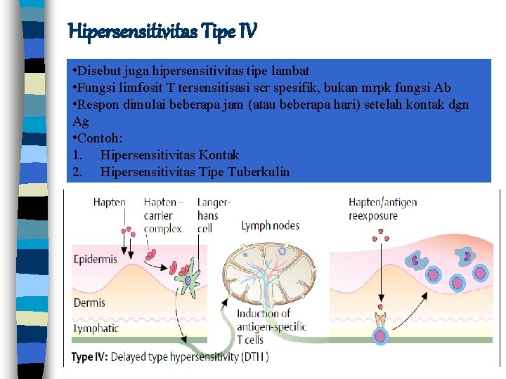 Hipersensitivitas Tipe IV • Disebut juga hipersensitivitas tipe lambat • Fungsi limfosit T tersensitisasi