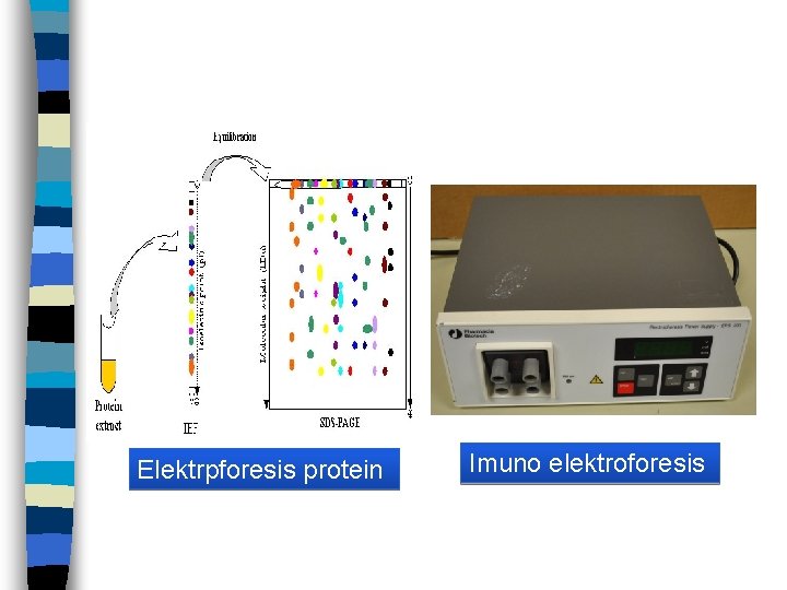 Elektrpforesis protein Imuno elektroforesis 