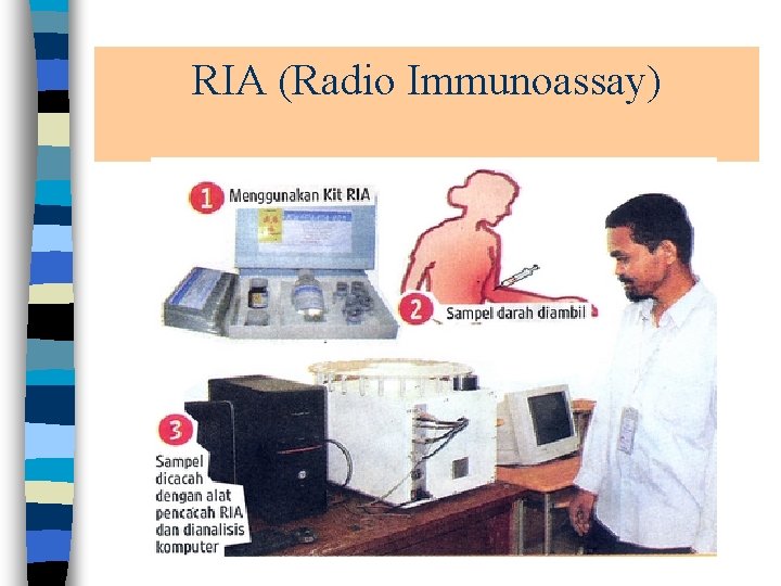 RIA (Radio Immunoassay) 