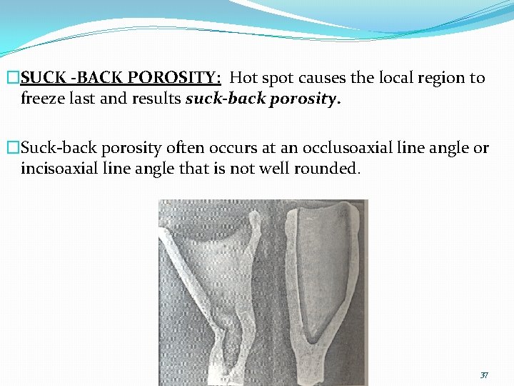 �SUCK -BACK POROSITY: Hot spot causes the local region to freeze last and results