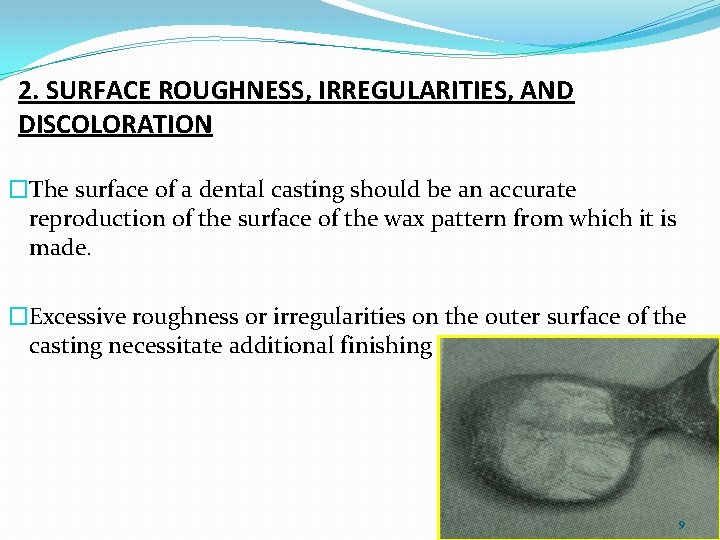 2. SURFACE ROUGHNESS, IRREGULARITIES, AND DISCOLORATION �The surface of a dental casting should be