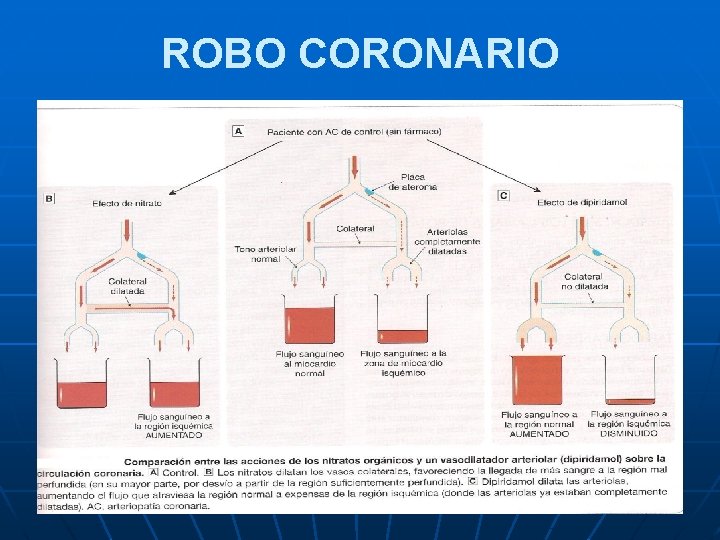 ROBO CORONARIO 