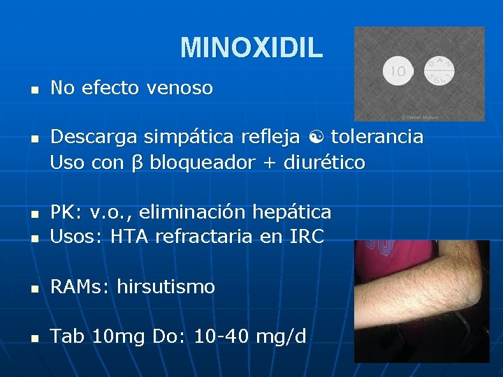MINOXIDIL n n No efecto venoso Descarga simpática refleja tolerancia Uso con β bloqueador