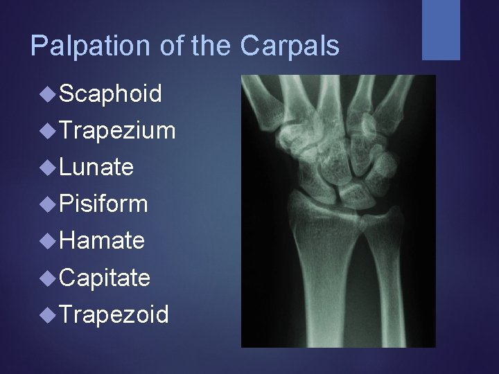 Palpation of the Carpals Scaphoid Trapezium Lunate Pisiform Hamate Capitate Trapezoid 