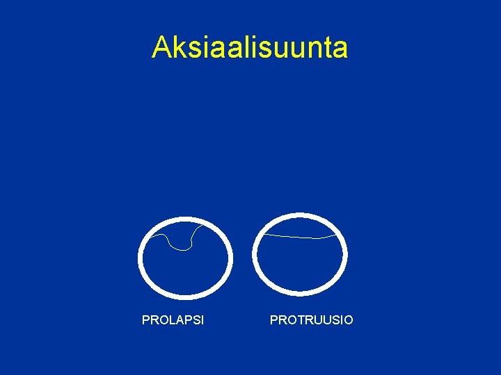 Aksiaalisuunta PROLAPSI PROTRUUSIO 