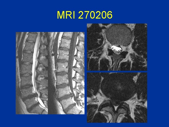 MRI 270206 