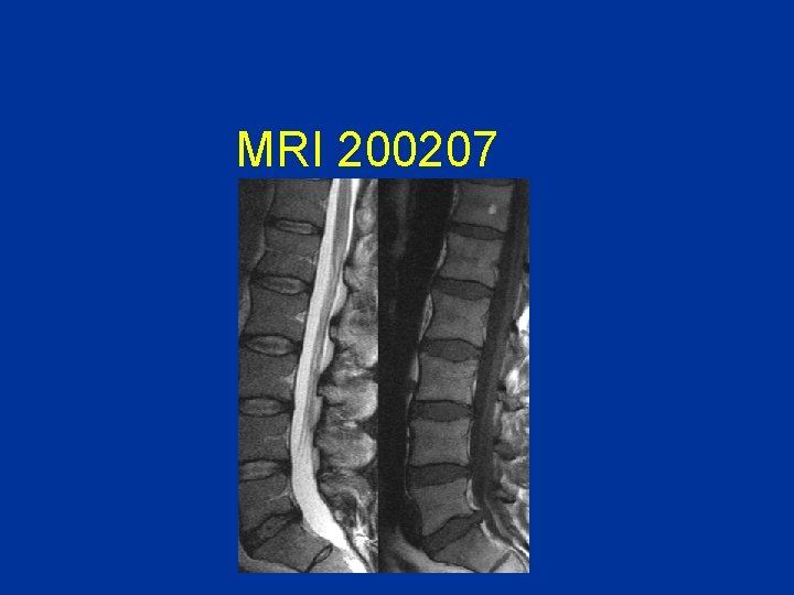MRI 200207 