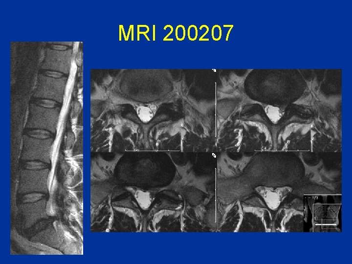 MRI 200207 MRI 200207