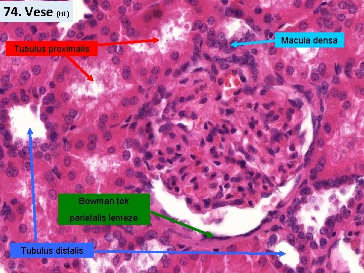 74. Vese (HE) Tubulus proximalis Bowman tok parietalis lemeze Tubulus distalis Macula densa 