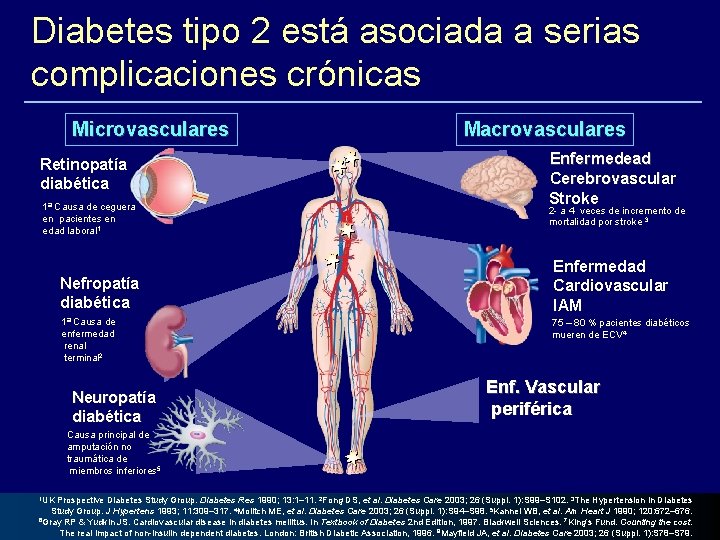 Diabetes tipo 2 está asociada a serias complicaciones crónicas Microvasculares Retinopatía diabética 1ª Causa