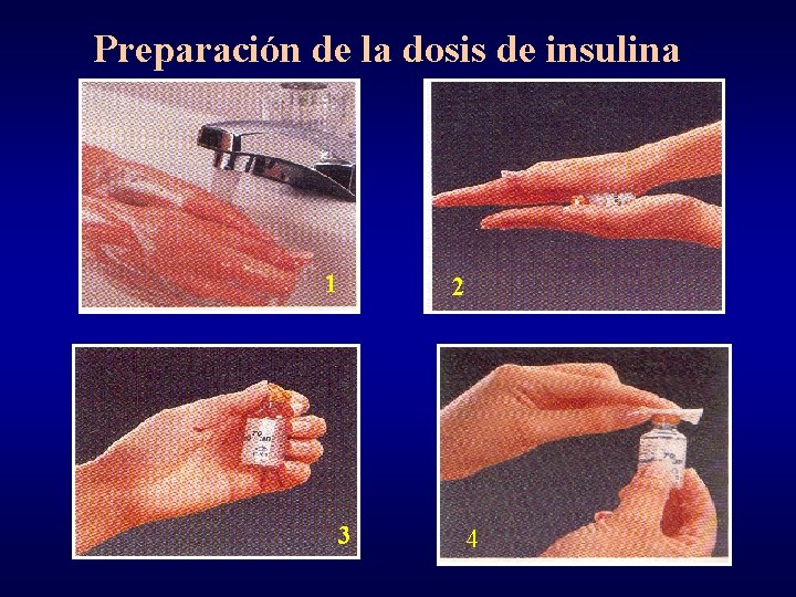 Preparación de la dosis de insulina 1 2 3 4 