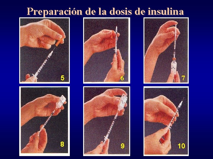 Preparación de la dosis de insulina 5 6 7 8 9 10 