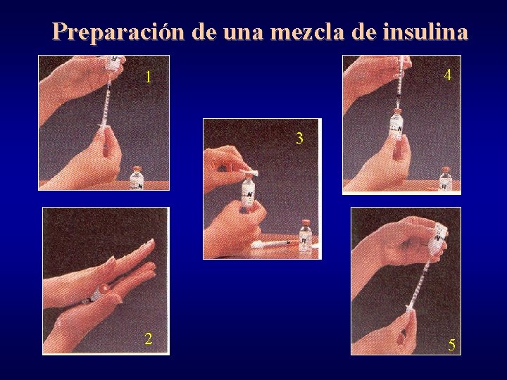 Preparación de una mezcla de insulina 4 1 3 2 5 