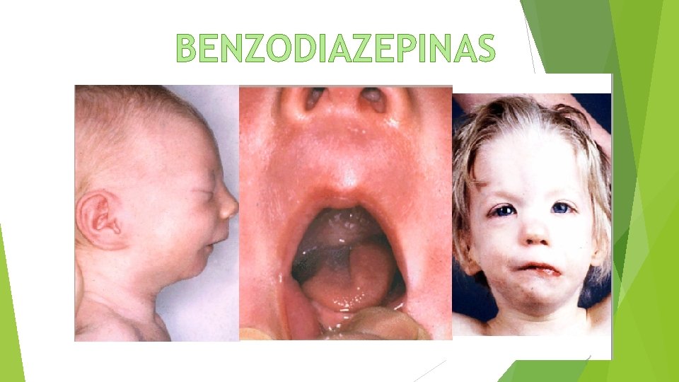 BENZODIAZEPINAS 