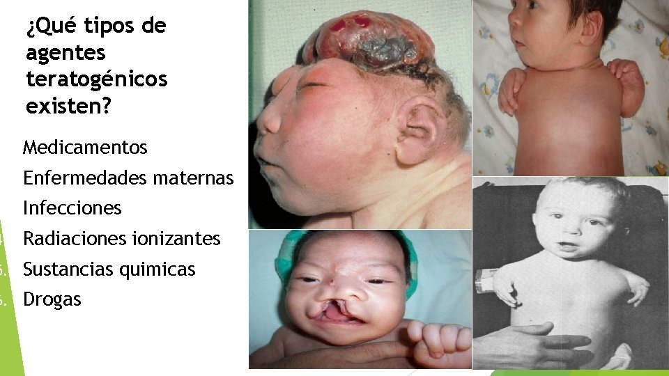 ¿Qué tipos de agentes teratogénicos existen? 1. Medicamentos 2. Enfermedades maternas 3. Infecciones 4.