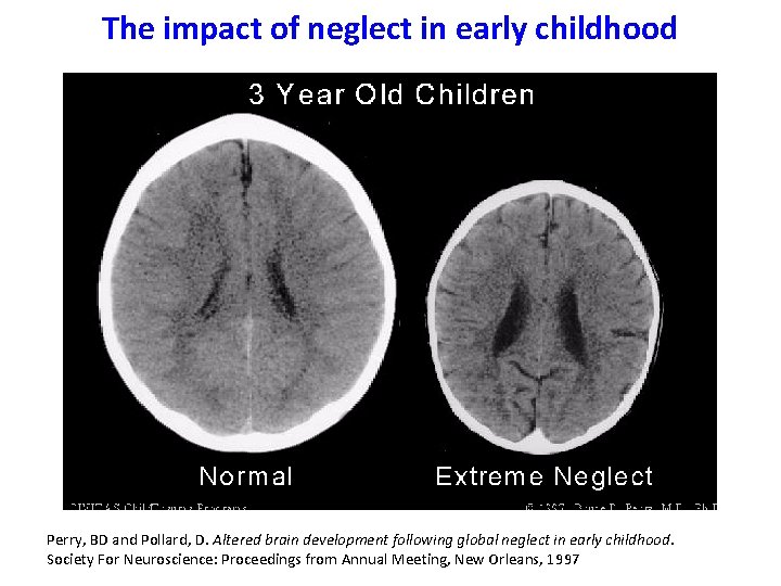 Altered Brain Development Implications of the new research for adolescent public