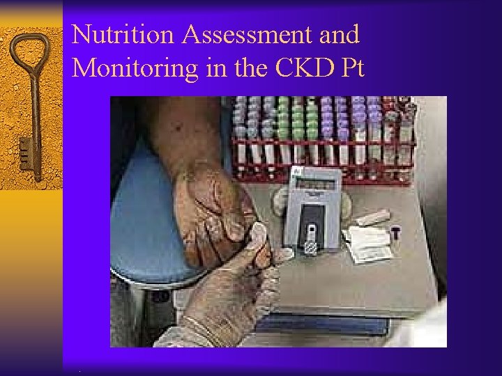 Nutrition Assessment and Monitoring in the CKD Pt . 