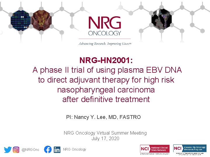 NRG-HN 2001: A phase II trial of using plasma EBV DNA to direct adjuvant