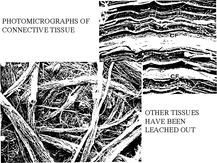 PHOTOMICROGRAPHS OF CONNECTIVE TISSUE OTHER TISSUES HAVE BEEN LEACHED OUT 