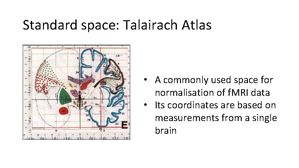 Standard space: Talairach Atlas • A commonly used space for normalisation of f. MRI