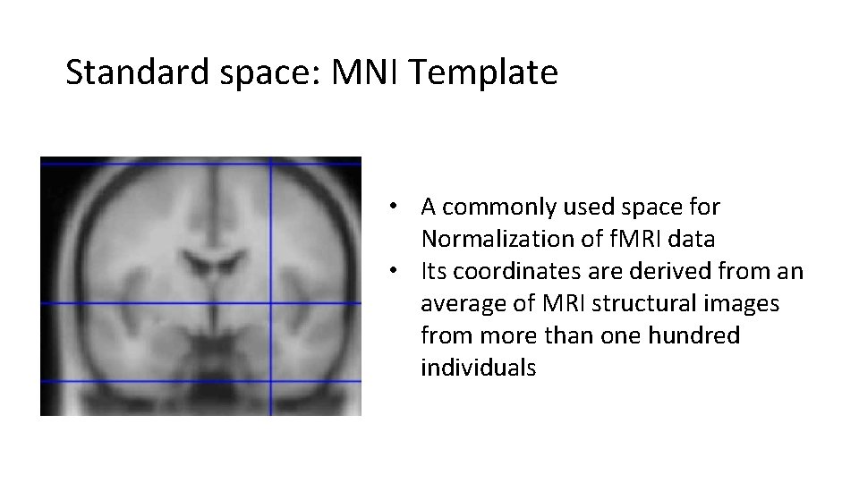 Standard space: MNI Template • A commonly used space for Normalization of f. MRI