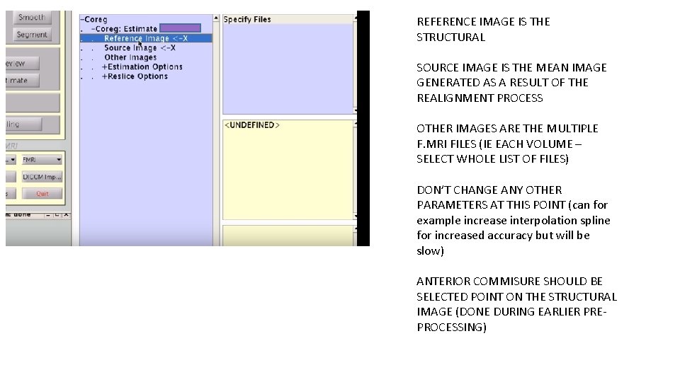 REFERENCE IMAGE IS THE STRUCTURAL SOURCE IMAGE IS THE MEAN IMAGE GENERATED AS A