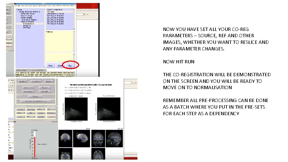 NOW YOU HAVE SET ALL YOUR CO-REG PARAMETERS – SOURCE, REF AND OTHER IMAGES,