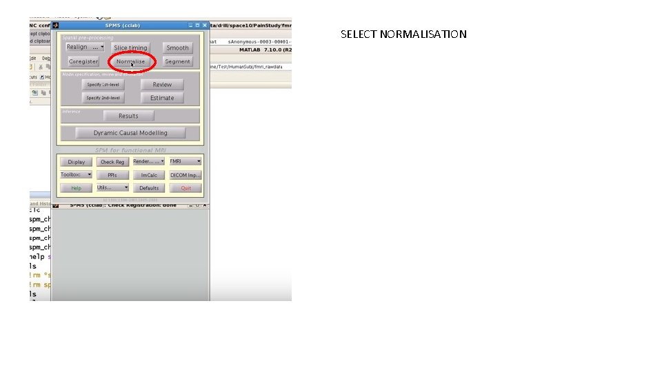 SELECT NORMALISATION 