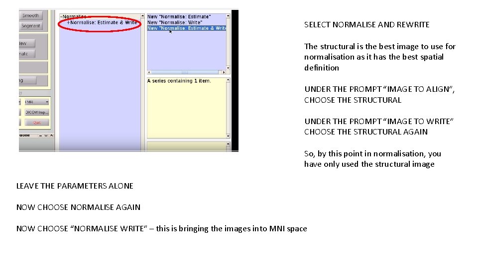 SELECT NORMALISE AND REWRITE The structural is the best image to use for normalisation