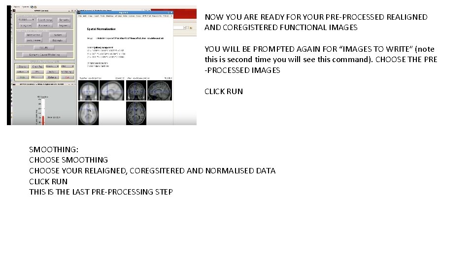 NOW YOU ARE READY FOR YOUR PRE-PROCESSED REALIGNED AND COREGISTERED FUNCTIONAL IMAGES YOU WILL