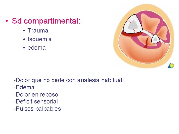  • Sd compartimental: • Trauma • Isquemia • edema -Dolor que no cede