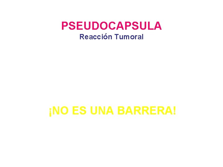 PSEUDOCAPSULA Reacción Tumoral ¡NO ES UNA BARRERA! 