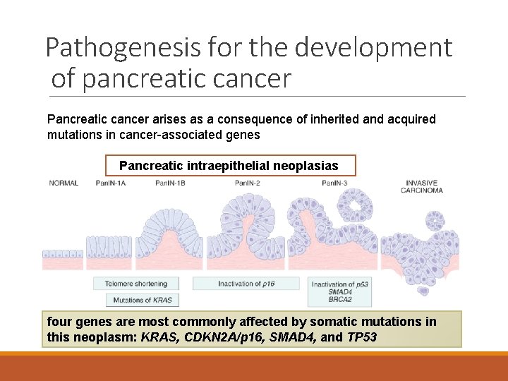 Pathogenesis for the development of pancreatic cancer Pancreatic cancer arises as a consequence of