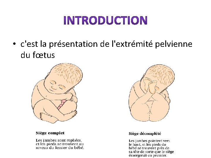  • c'est la présentation de l'extrémité pelvienne du fœtus 