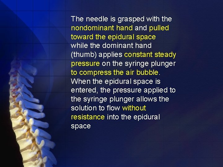 The needle is grasped with the nondominant hand pulled toward the epidural space while